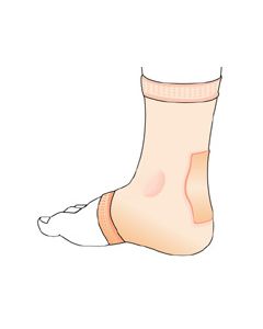 Luga Comforsil  Silicone Achilles Heel Pad Protects - kaitseside kannakõõluste toetamiseks